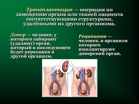 Основы трансплантологии - презентация онлайн