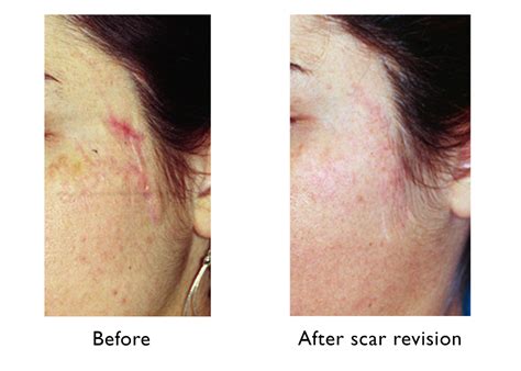 scar face costumes 2