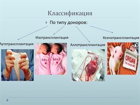 Хирургические аспекты в трансплантологии - презентация онлайн