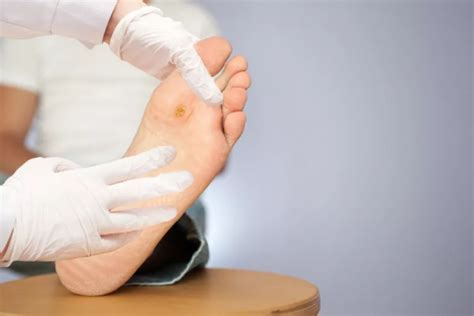 Трофична язва: причини, симптоми и лечение — Medconsult.bg