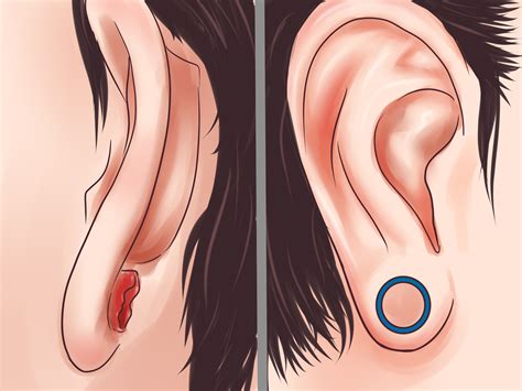 Ear Stretching Infection