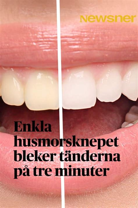 Vita tänder: Här är enkla husmorsknepet som bleker tänderna på tre ...