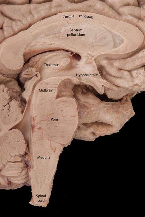 Brain stem magnification model two parts of brain stem sagittal section ...