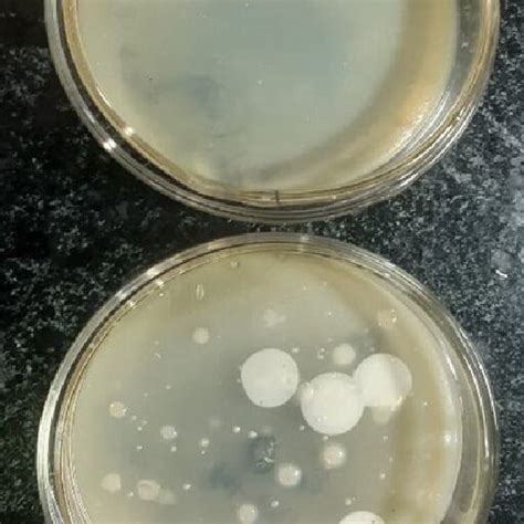 bacterial colonies  egg yolk     settle plate method