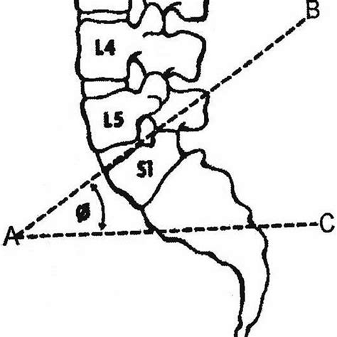 show   vertical angle  sacral curvature  sacral angle