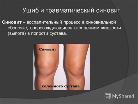 Презентация на тему: "«Повреждения и заболевания коленного сустава ...