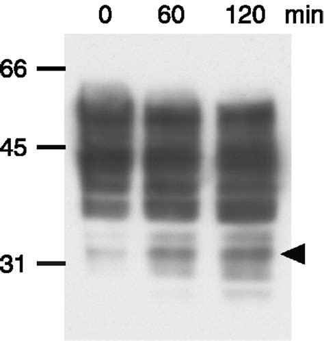 A model of the acrosome reaction progression via the acrosomal membrane ...