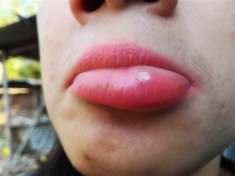 That sudden feeling why your lips are quivering is actually quite common 29