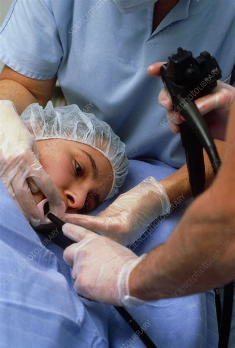 endoscopy stock image  science photo library