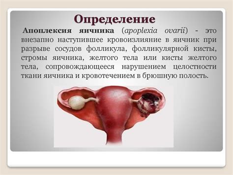 Апоплексия яичника - презентация онлайн