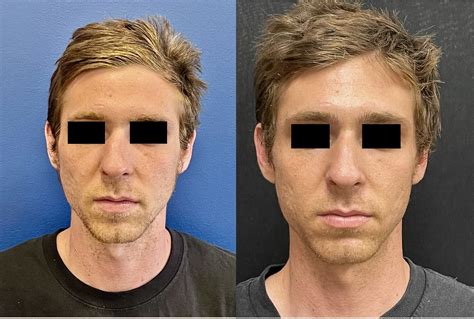 Murrieta Patch: Before & After Photos Will Astound You! Image 1