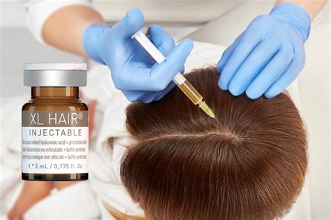Мезотерапия XL HAIR: эффект, курс процедур, цены