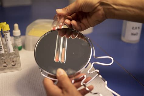 Un nou test de sange poate diagnostica un cancer ovarian nedetectabil ...