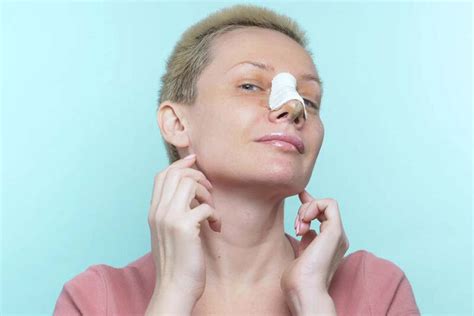 breathing  life  ultimate guide  rhinoplasty  australia