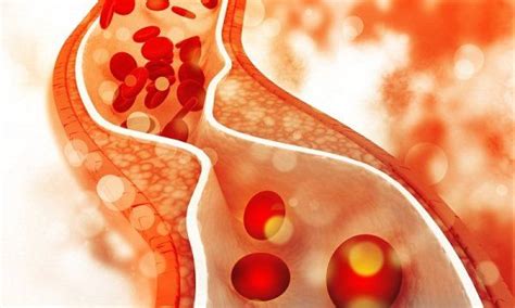 Japet Hộp 30 Viên - Hỗ Trợ Làm Giảm Cholesterol Trong Máu
