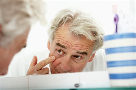 Styes vs. Chalazia - Bruder Healthcare