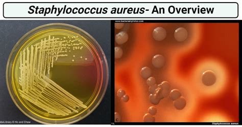staphylococcus aureus  overview microbe notes