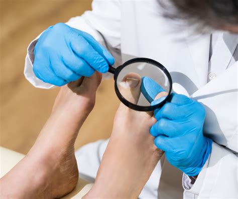 What You Need to Know About Fungal Toenail Infection – Tucson Podiatrist