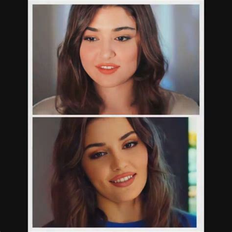 Before and after plastic surgery in 2022 | Plastic surgery, Hande ercel ...