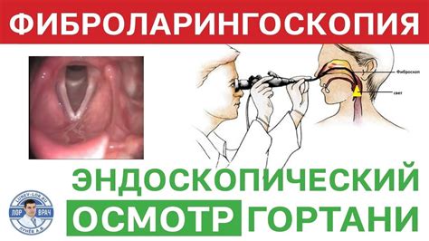 Непрямая ларингоскопия гортани без патологии - YouTube