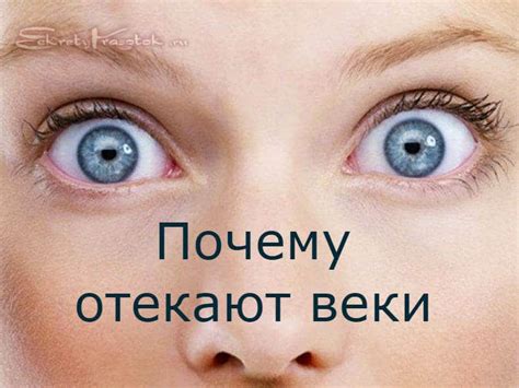 Отек век: причины, виды, лечение — Секреты Красоток