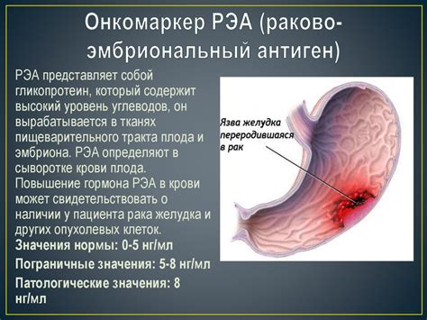 Онкомаркеры. Таблица комбинации опухолевых маркеров - презентация онлайн