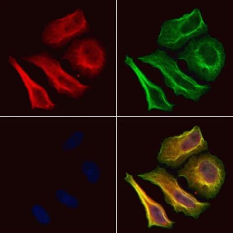 invitrogen phospho foxo ser polyclonal antibody  ml buy