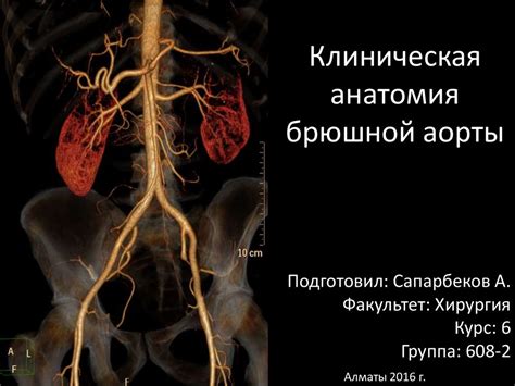 Клиническая анатомия брюшной аорты - презентация онлайн