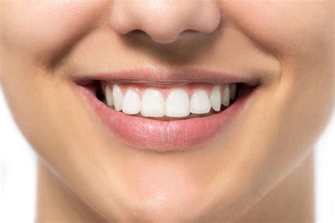 Can I reshape my canine teeth? (4 options for you)