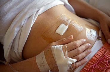 Лапароскопия почки. как проходит операция. восстановление и диета после ...