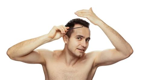 How Ayurveda Treats Bald Patches in 5 Ways | Alopecia Treatment