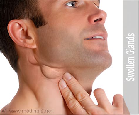 food  swollen glands  mitzi mcclain blog