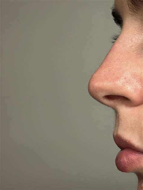 what kind of nose do I have ? Greek ? : r/Noses