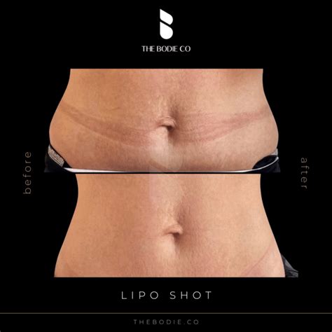 Lipo Shot Injection - The Bodie Co