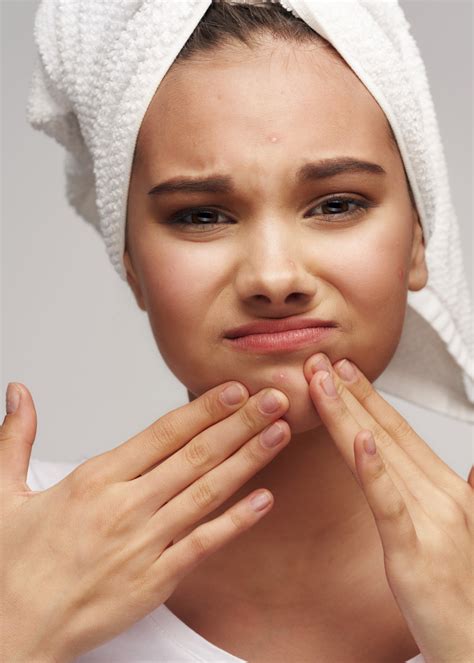 Best Makeup To Cover Red Acne Scars - Makeup Vidalondon