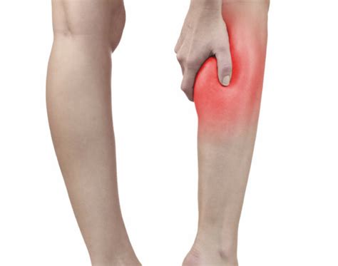 Leg Cramps: Causes, Symptoms & Relief | Crampeze AU