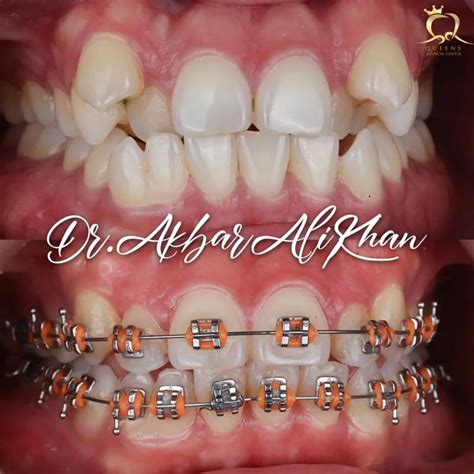 dr akbar ali khan  instagram      people  seey