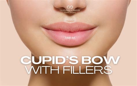create  cupids bow  fillers la clinique privee plastic