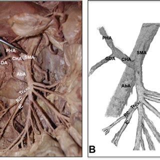 Costocervical Trunk Cadaver