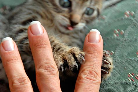 Болезнь кошачьих царапин: насколько опасен фелиноз