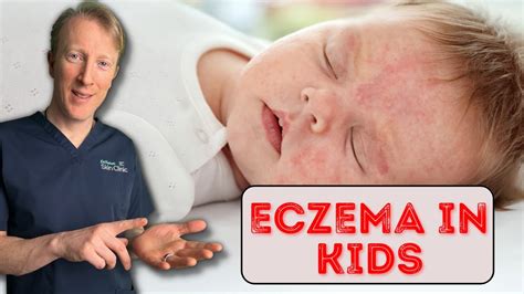 How to treat Eczema in Babies & Children: Dermatology Doctor explains ...
