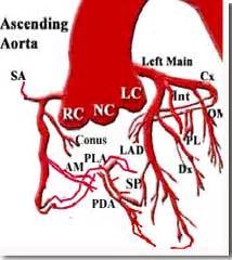 Coronary Artery: Coronary Artery Ramus
