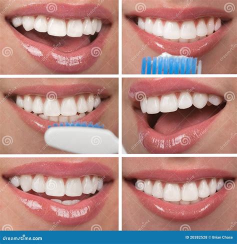 Healthy Teeth stock photo. Image of makeover, cosmetic - 20382528