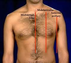 Exam 2: Cardiovascular Assessment Flashcards | Quizlet