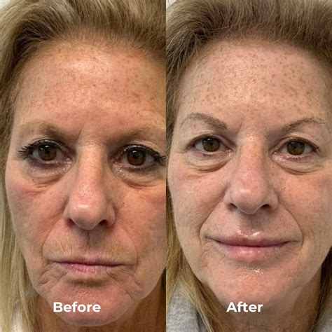 Jw Woodward: Before & After Results That Will Shock You Image 11