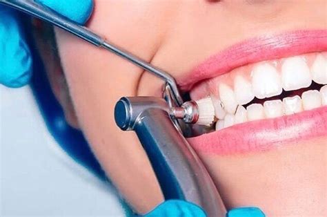 Pin on Dental social media | Dental cleaning, Dentist, Cosmetic dentist
