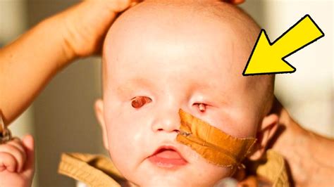 Когда родители увидели сына, они хотели отказаться от него! - YouTube