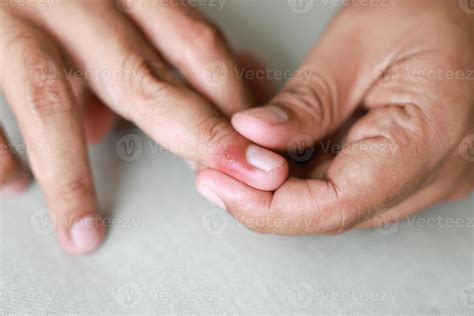 how to know when a cut is infected 8