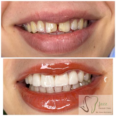 Jazz dental clinic - Home