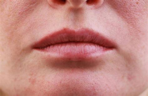 top reasons   face   red    address  unique